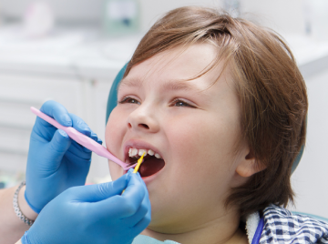 Fluoride Treatments for Kids: Why They’re Essential for Healthy Teeth